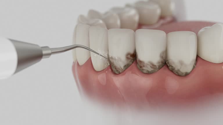 Reliable Wisdom Tooth Removal contractor in Benton County County, IA by Dentist Open Now